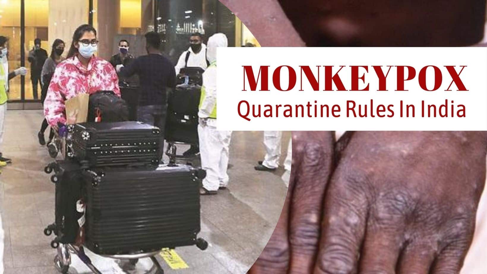 What Happens If You Test Positive For Monkeypox In India? Quarantine Rules And Other Details